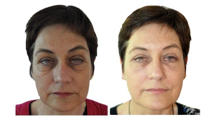 Chirurgien esthétique et plastique à Montpellier